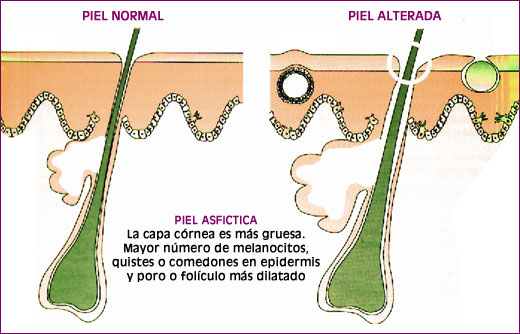 Piel Asfíctica