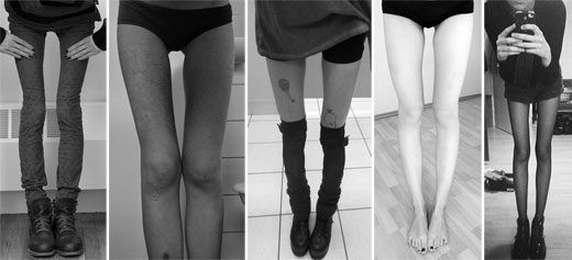 THIGH GAP