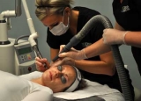 Correcciones faciales con lser